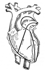 Правила вскрытия с целью исследования состояния отдельных органов: сердца