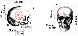 Схема повреждений черепа Николая Тибо-Бриньоля