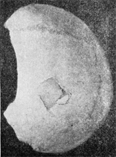 Террасовидный перелом, оставленный ударом торцевой части деревянного бруса
