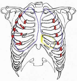 Схема показывает примерные повреждения грудной клетки Людмилы Дубининой